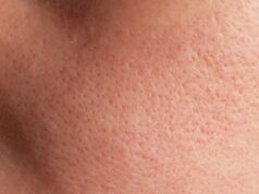 The Secret to Minimising Large Pores: A Nurse’s Real-Life Protocol for Flawless Texture The Secret to Minimising Large Pores: A Nurse's Real-Life Protocol for Flawless Texture
