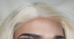 The Dark Side of the Mirror: How the "Botched Lookalike" Trend Is Transforming Aesthetic Medicine
