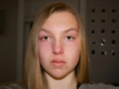 Is ‘Cortisol Face’ Real? The Science Behind the Viral Puffy-Face Theory Is 'Cortisol Face' Real? The Science Behind the Viral Puffy-Face Theory