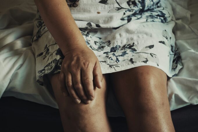 anna-auza-dzhlKUgyI3M-unsplash Sclerotherapy for Spider and Varicose Veins: What Actually Happens During Treatment
