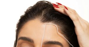 The Art of the Aesthetic Revision: How Top Surgeons Correct Failed Cosmetic Procedures
