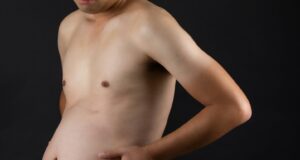 Beat the Bloat: Why Hot Weather Makes You Feel Puffy (and How to De-Puff Fast)