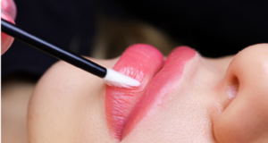 'M-Shaped Lips': The Filler Look Everyone's Searching For