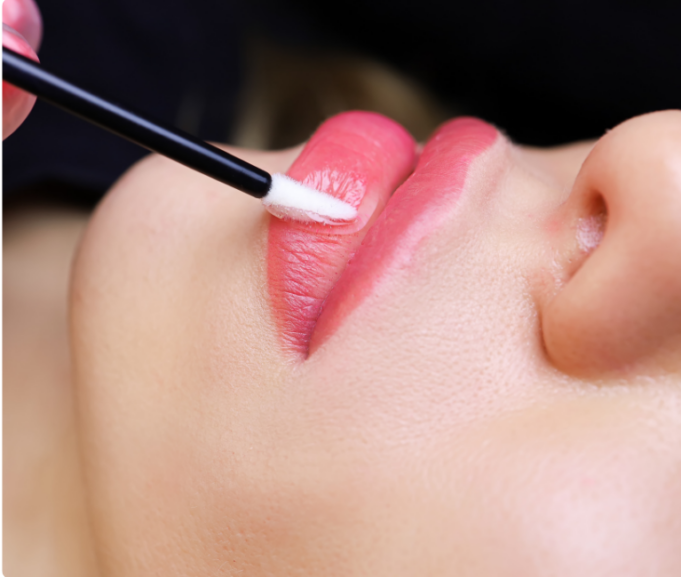 (Bulk 1) Copy of THSJ TEMPLATE 2 (1) 'M-Shaped Lips': The Filler Look Everyone's Searching For