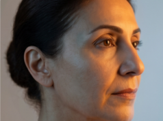 Redness or Pigment? Why Your Skin Concern Might Be Misdiagnosed Redness or Pigment? Why Your Skin Concern Might Be Misdiagnosed