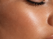 Skin Quality 101: Pores, Dullness and Texture Skin Quality 101: Pores, Dullness and Texture