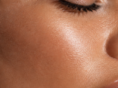 Skin Quality 101: Pores, Dullness and Texture Skin Quality 101: Pores, Dullness and Texture