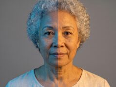 Vascular vs Pigmented Lasers: Know Before You Book Vascular vs Pigmented Lasers: Know Before You Book