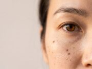 Under-Eye Hollows: Why Filler Isn’t Always the Fix Under-Eye Hollows: Why Filler Isn't Always the Fix