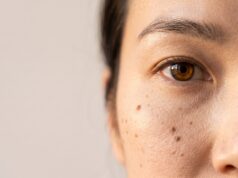 Under-Eye Hollows: Why Filler Isn’t Always the Fix Under-Eye Hollows: Why Filler Isn't Always the Fix