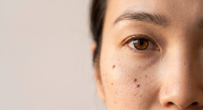 Gemini_Generated_Image_knxezeknxezeknxe Under-Eye Hollows: Why Filler Isn't Always the Fix