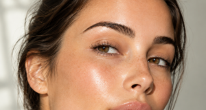 Acne Through the Decades: Teens to Adult Scarring